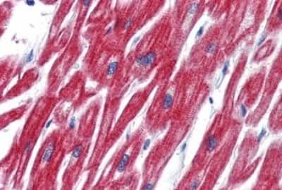 Immunohistochemistry-Paraffin: OLFM4 Antibody [NBP3-14432]